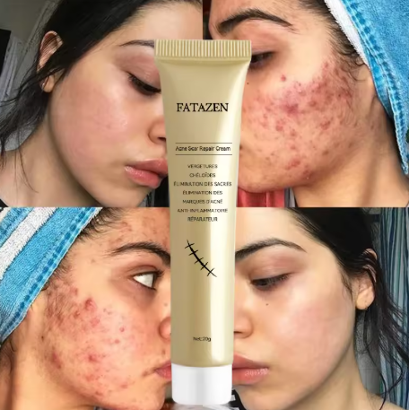 Fatazen Anti-Cicatrice