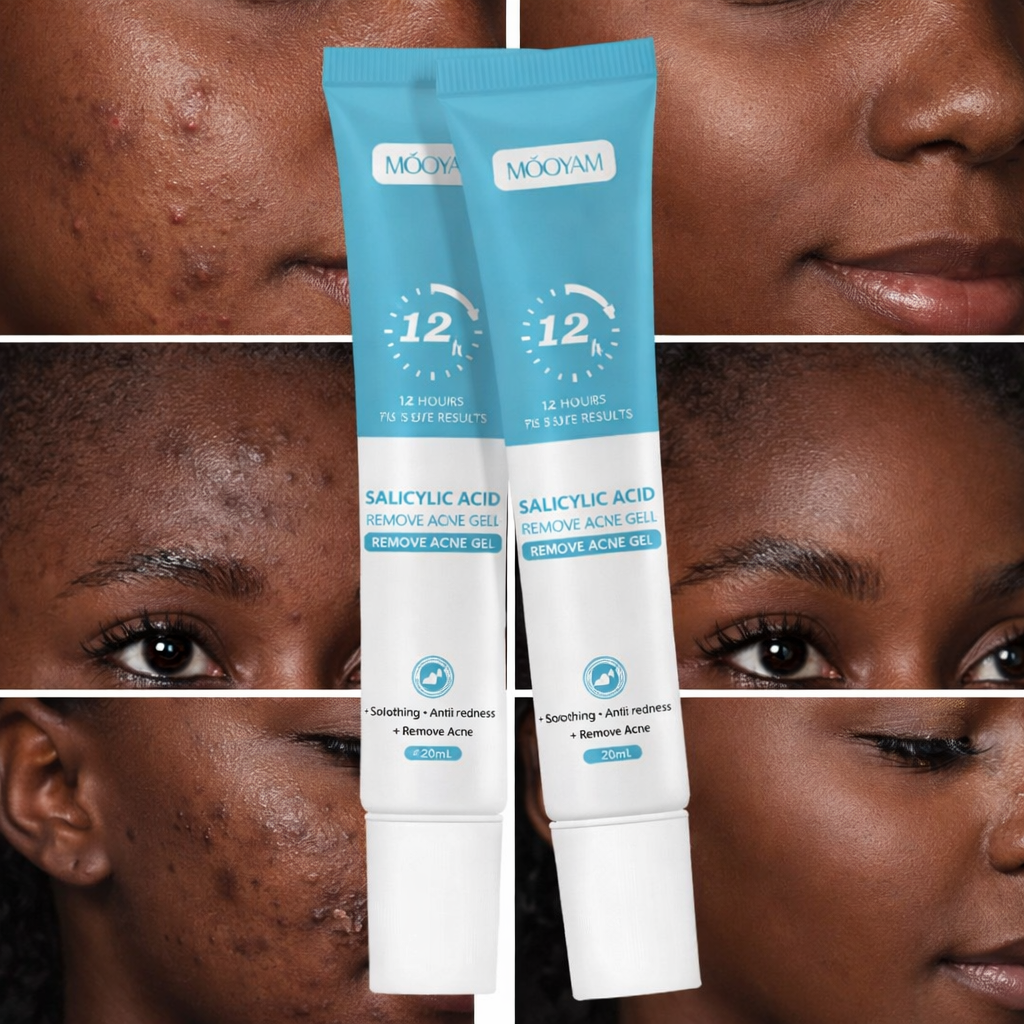 Mooyam Gel Anti-Acné