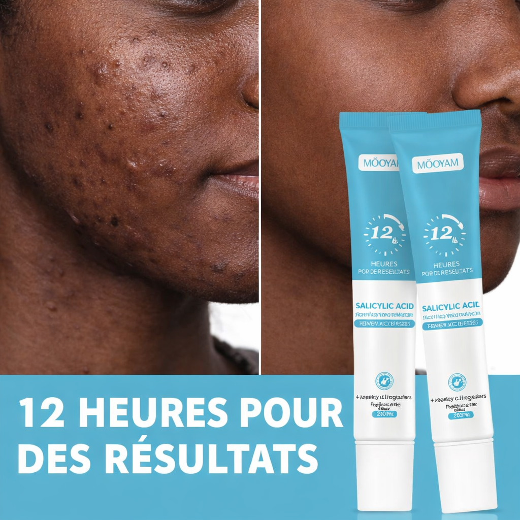 Mooyam Gel Anti-Acné