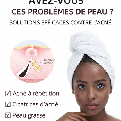 Mooyam Gel Anti-Acné