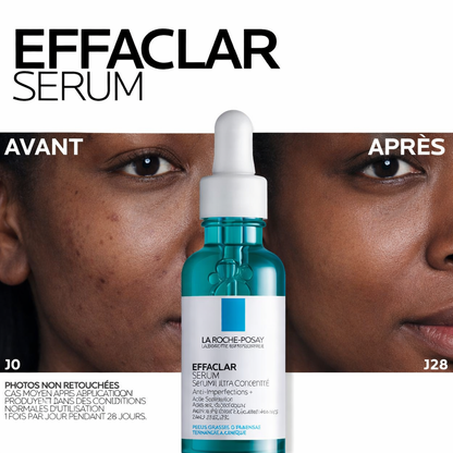 La Roche-Posay Effaclar Sérum Ultra Concentré Anti-Imperfections - 30 ml