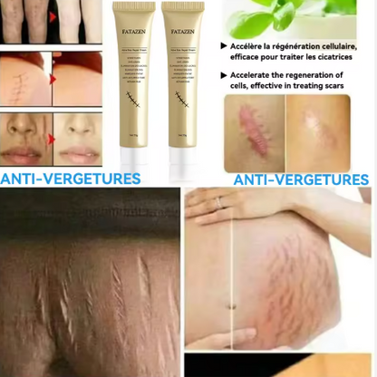 Fatazen Anti-Cicatrice