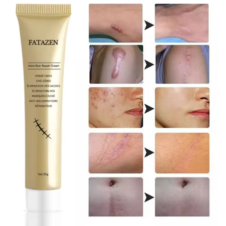 Fatazen Anti-Cicatrice